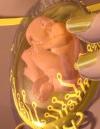 Necklace (IVF)
